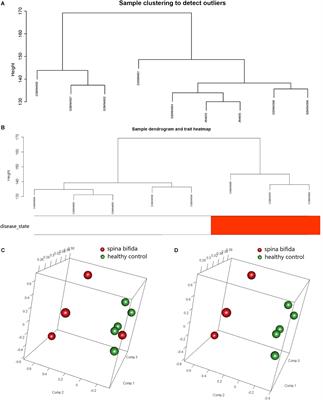 Key Modules and Hub Genes Identified by Coexpression Network Analysis for Revealing Novel Biomarkers for Spina Bifida